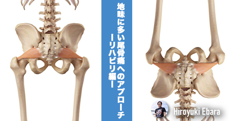 地味に多い尾骨痛へのアプローチ～リハビリ編～ | 理学療法士・作業療法士・言語聴覚士の求人、セミナー情報なら【POST】
