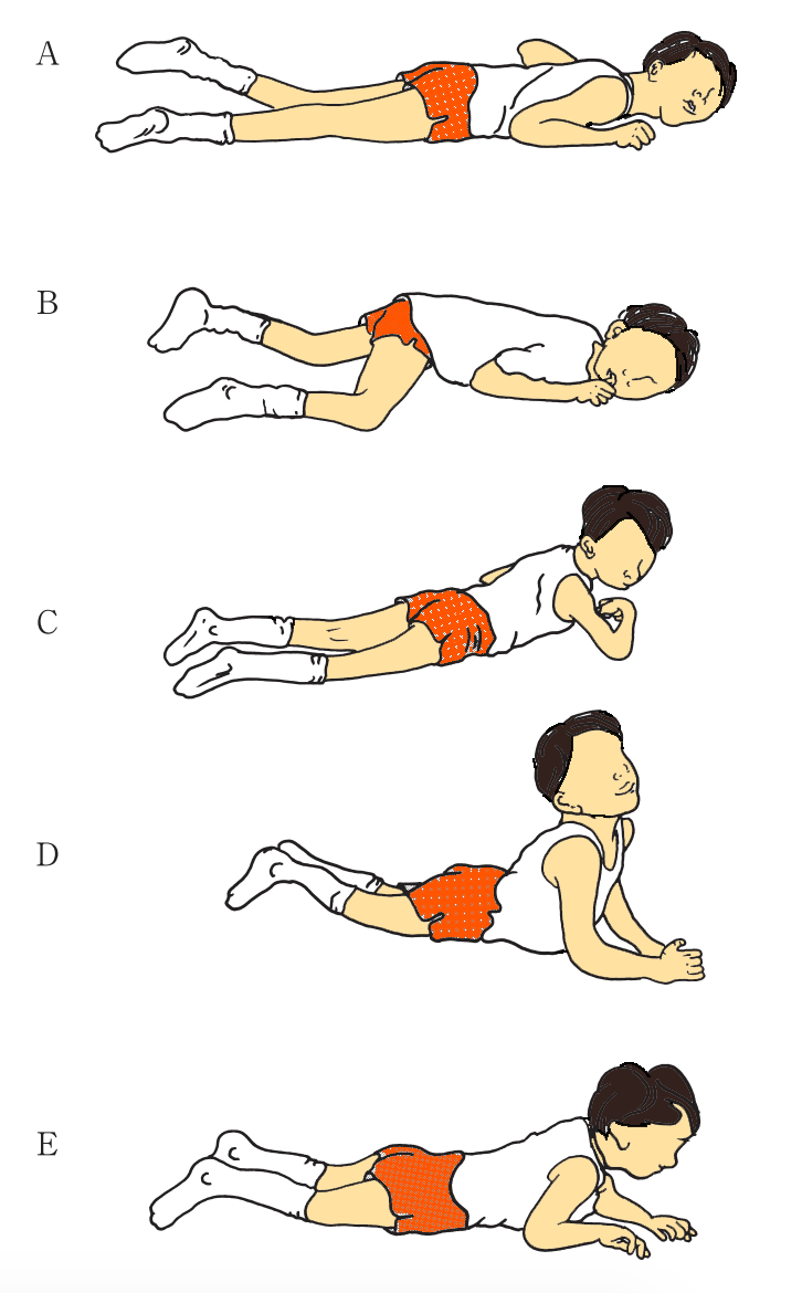 クイズ】作業療法士の国家試験に挑戦⑦｜脳性麻痺 | 理学療法士・作業