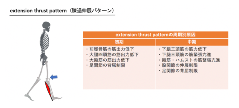 脳卒中】膝関節過伸展に対する介入とエビデンス | 理学療法士・作業